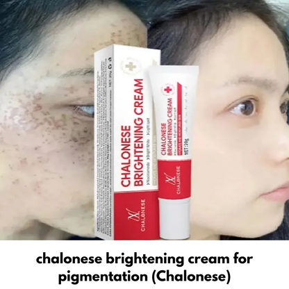 Buy 1 Get 1 Free - Chalonese Brightening Cream