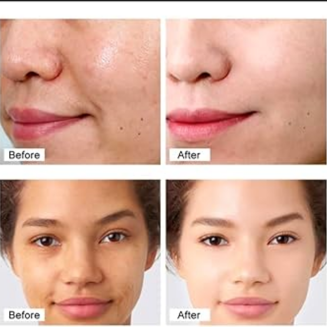 Buy 1 Get 1 Free - Chalonese Brightening Cream